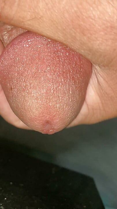 Penis saya terbakar dan saya akan berhubungan seks dengan satu orang lalu menyemprot sperma ke seluruh tubuhnya