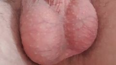 Saggy balls and closeup contractions