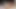 ブルーランジェリー レズビアン 69