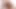 Lizzy Yum SD August 2025 Dilating #50