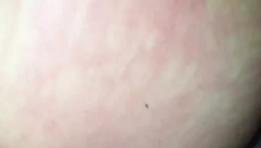 anal