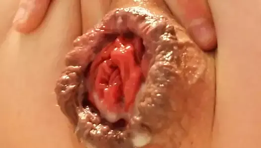 Prolapsus squirting sperme dump rosebud trou du cul béant analgasim