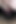 Lesbian Hairy Pussy Eating Close up