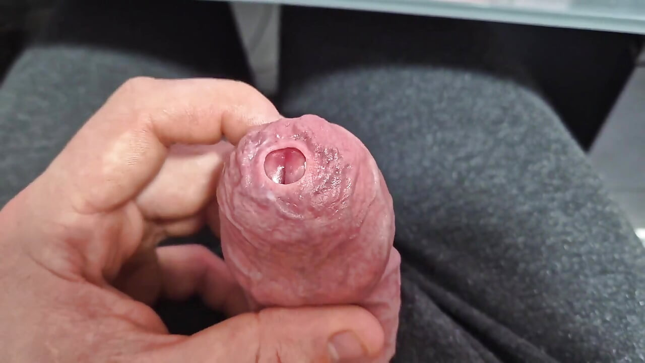 Tight Phimosis Foreskin Stretching with Cumshot!