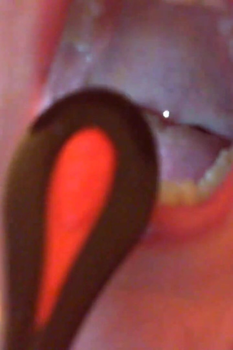 Mouth Exploration