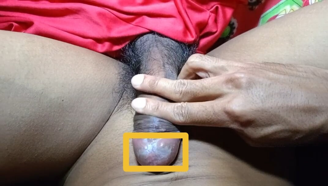 The cock is fungus