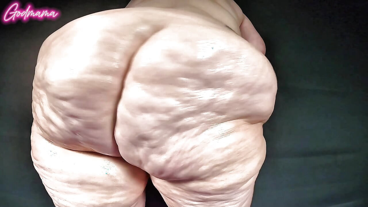 超級橘皮組織屁股