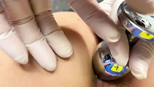 Ich habe den anus meiner ehefrau auf 4cm vergrößert