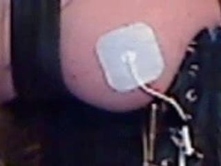 Elektrische Stimulation der rechten Brust