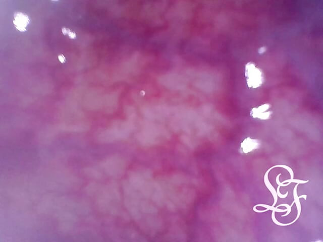 Explorando as Profundezas da minha Bunda com a Minicam!