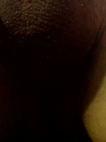 Droch