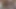 Lizzy Yum VR July 2023 JUST independence Post-Op Orgasm Pussy Clit Masturbation Teasing Orgasm