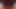 Französische Ebenholz-Krankenschwester von weißem Pacient gefickt