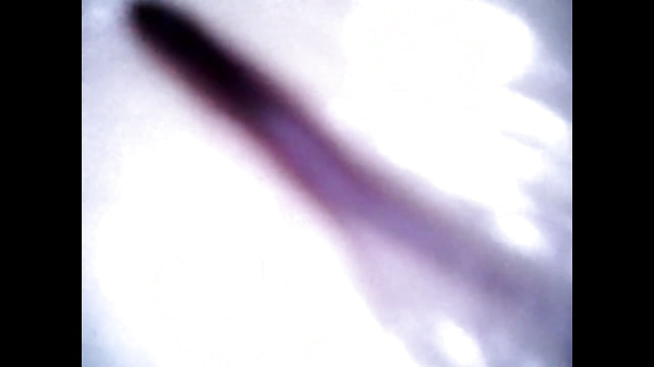 Endoscope Details - Hole Balls Cock Foreskin Belly Nipples Mouth Sperm