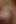 Stepmom prolapse her cervix by rough fisting