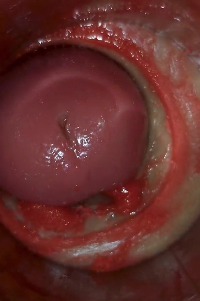 Kamera Unutar Duboke Pičke Snima Ogromnu Ejakulaciju Sperme Asmr