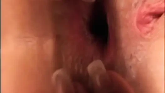 Anal sondaj derlemesi