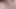 COCK SOUNDING  CBT