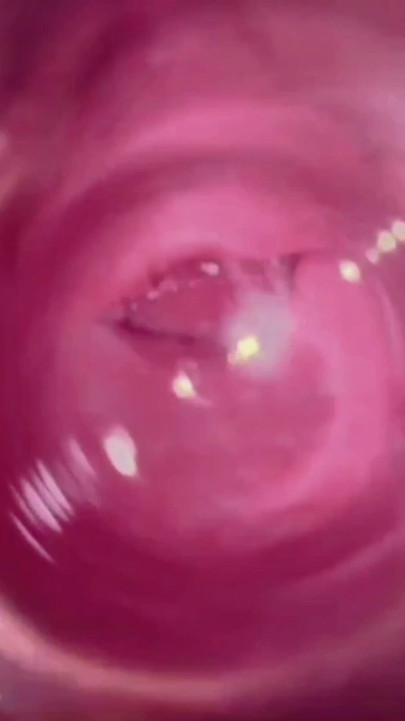 SUPER CLOSE UP - this is what the inside of the vagina looks like | Clip 1