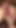 Cheating! a Married Slut Begs for Cum in Her Prolapsed Vagina
