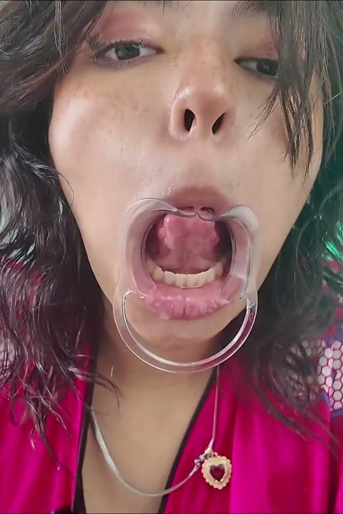 Cheeks Pulled Apart Teeth Exposed