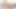 Volles video tvnka bedient