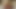 愚かな醜いブロンドのDp