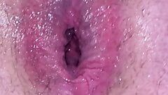 Hollow anal plug pulled out and deep and wide anal gape is the result with some puckering as well.
