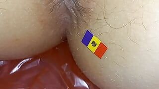 Chisinau Moldova anus