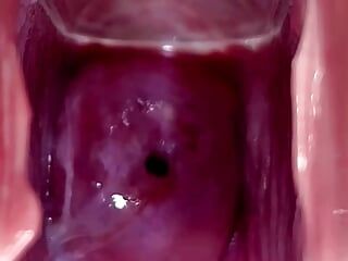 Colo do útero latejante e fluindo escorrendo porra durante close-up do espéculo