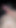 18y Foreskin cock playing