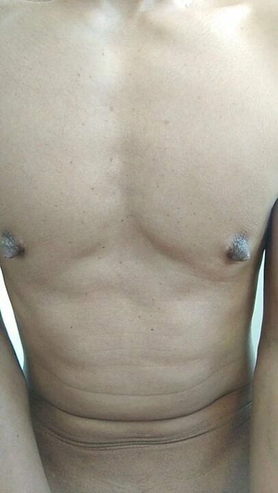 nip
