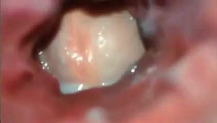 Anal inside camera