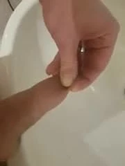 pee balloon and precum