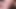 Foreskin closeup 335