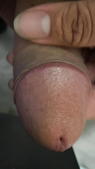 A lump of leftover flesh is growing in a rage, it must release the slime contained in it in the most drastic way