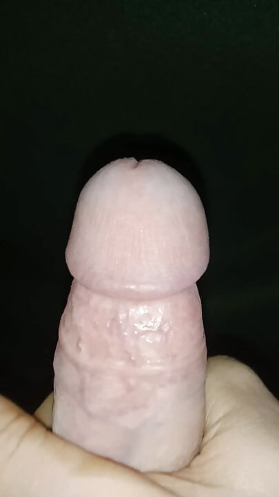 Iritasi tenggorokan