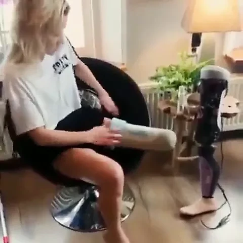 amputee