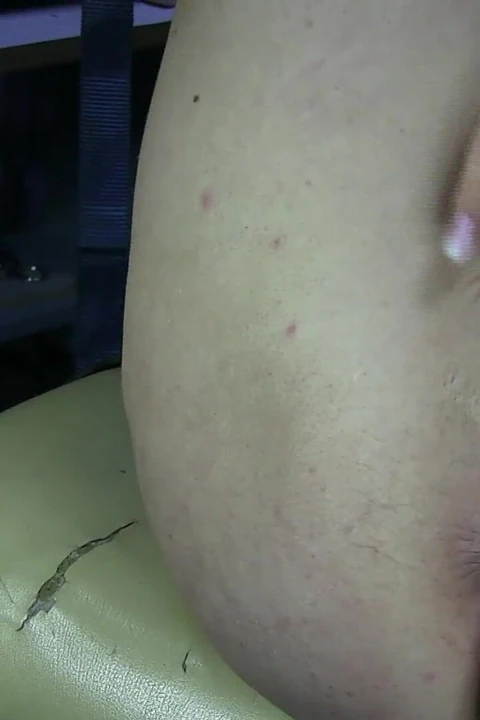 Labia Spreading Close up 2