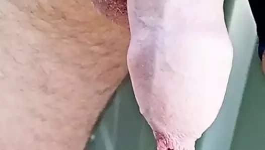 Slowmo sünnet derisi işemek