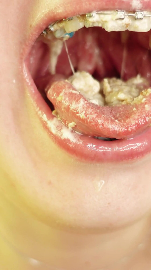 eating in braces - vore and food fetish - close up video | Clip 3