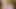 彼氏は、病院の医師とセックスした後、帰宅後にスパンキングで彼女を訓練します(#334)