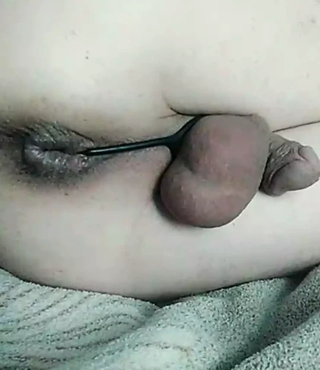Gaping hole in the anus