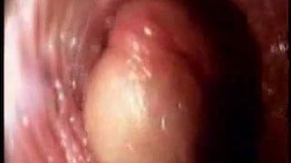 Video from the inside of a vagina... very interesting