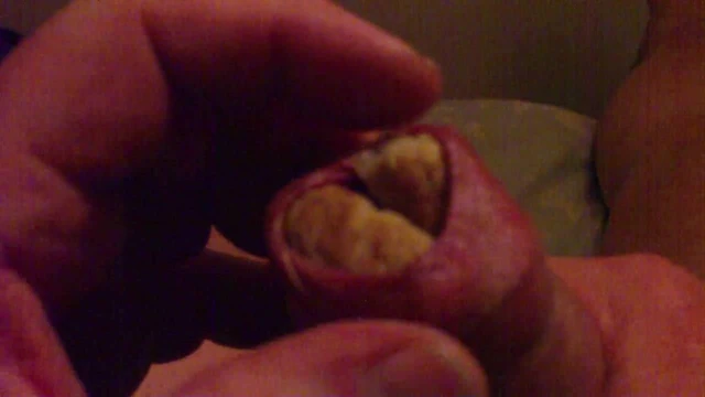 Night-time foreskin with sausages !