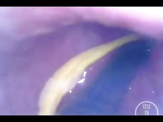POV: Umuti mi guzicu dok si unutra!