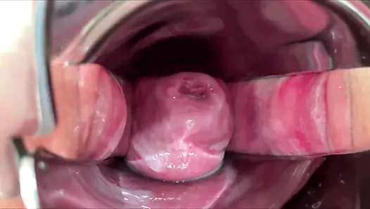 Masked Schoolgirl Extreme Cervix View and Double Vaginal Fisting