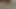 LizzyYum VR december 20 2023 Post Op Orgasm Pussy Masturbation Teasing