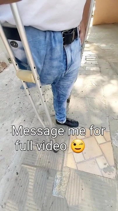 AMPUTEE guy  walking with skinny jeans