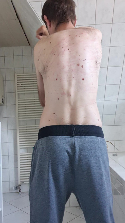 Self-flagellation in the morning